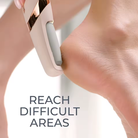 Belvani™Callus Remover